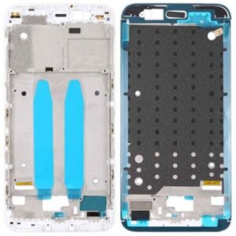شاسی شیائومی مدل Xiaomi Mi 5x/Mi A1