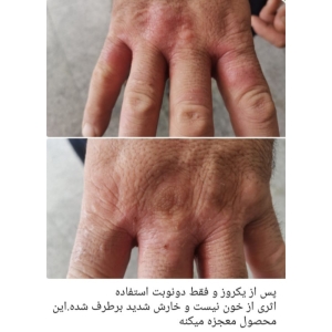 سرم ضد چروک و بر طرف کننده خط اخم و چروک دور چشم سی ای مدل سلولار فیلر 5 ml