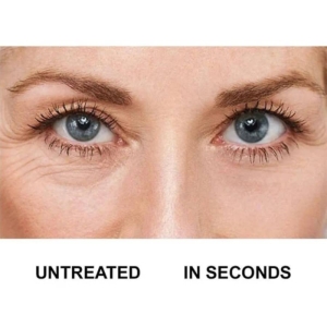 کرم بوتاکس فوری زیر چشم آونAVON حجم 15 میل