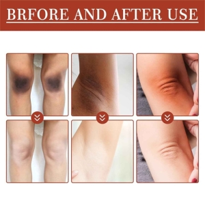 روغن لایه بردار پوست eelhoe حجم 110 میل