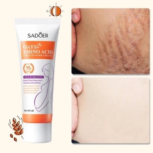 کرم ترمیم کننده استرچ مارک سادور حاوی جو دوسر و آمینو اسید وزن 40 گرم