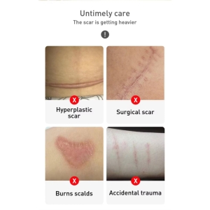 ژل ترمیم کننده جای جوش و اسکار لانبنا LANBENA مدل SKIN CARE وزن 30 گرم