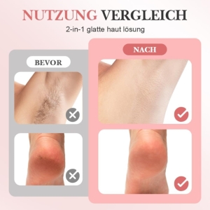 سنگ پا شارژی مدل hair remover