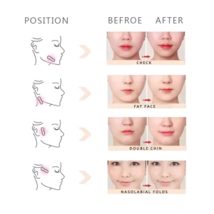 چسب لیفت صورت وشقیقه بسته ۴۰ عددی