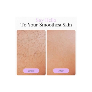 سرم بازدارنده رشدموسادورحجم ۳۰ میل