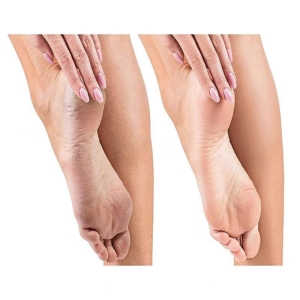 سنگ پا شارژی مدل XG-P8020