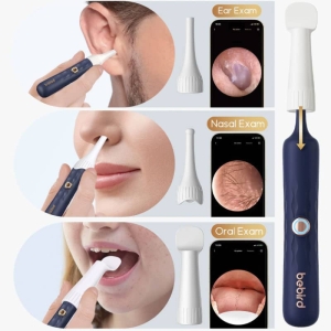 گوش پاک کن هوشمند شیائومی مدل Bebird I35R 